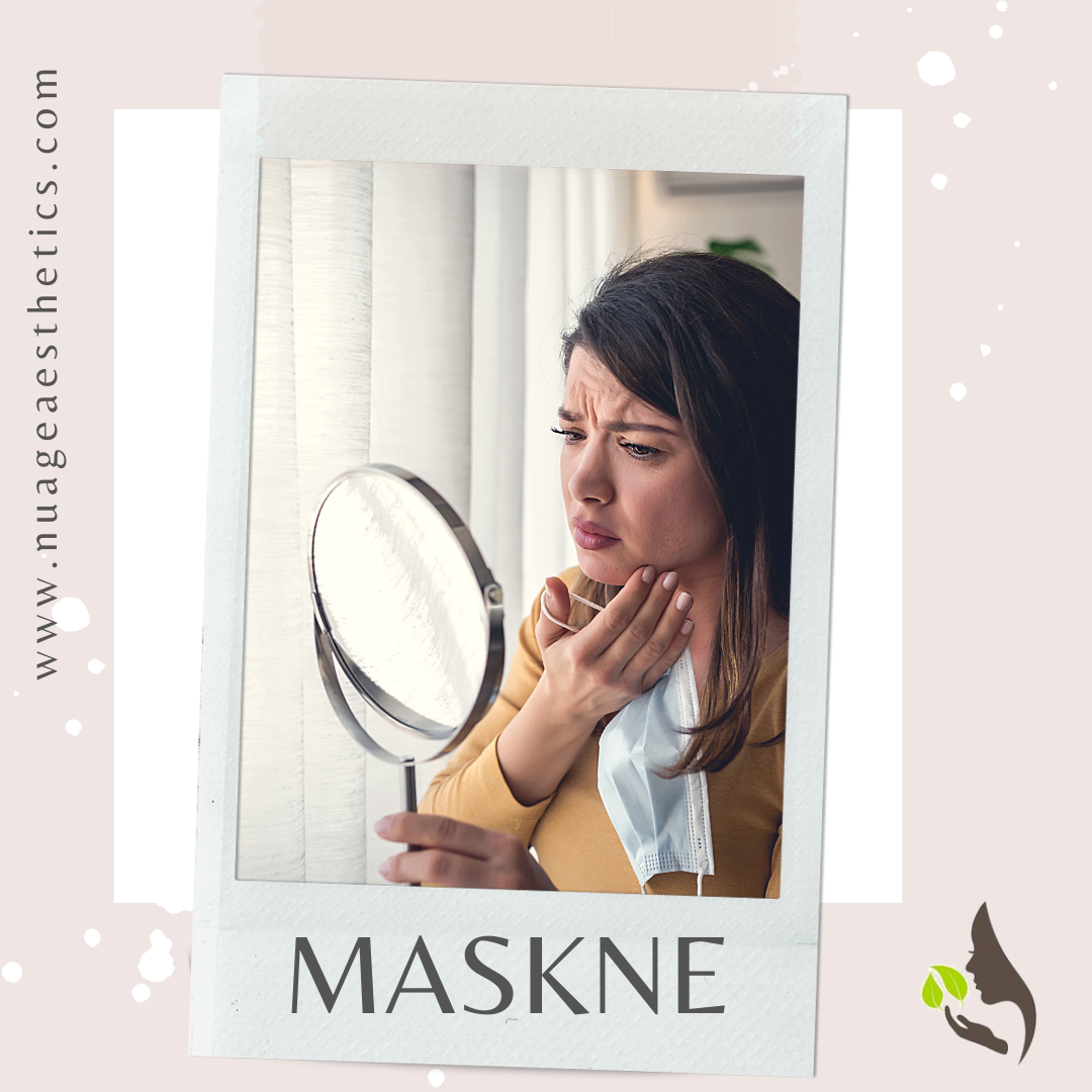 What Is Maskne - Acne | Skin Care Tips at Nu Age Aesthetics Advanced Medical Spa