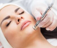 a woman getting a Microdermabrasion treatment for her face