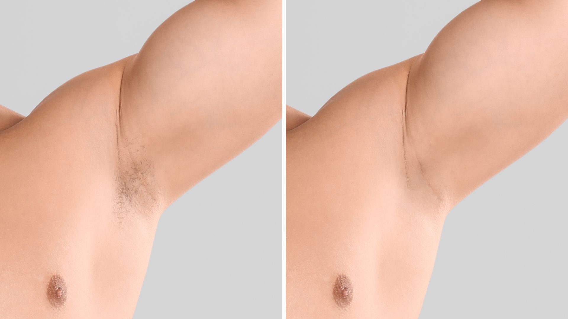 picture of man before and after hair removal